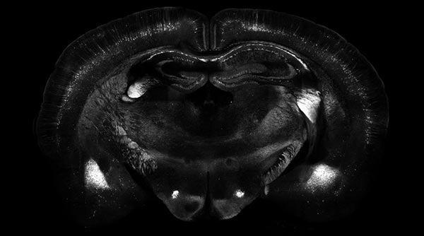 Image of a mouse's brain